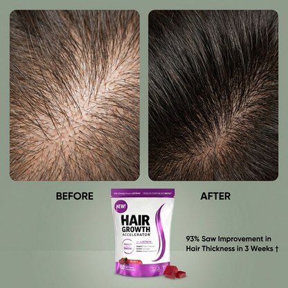 GlowUp Collagen Hair Growth Gummies