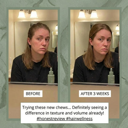 GlowUp Collagen Hair Growth Gummies